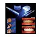 Σύστημα Λεύκανσης Δοντιών 20' Dental Whi